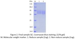 Bon Opus Biosciences Recombinant Human IL-21R (C-His) - Source: Human 293