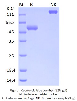 Bon Opus Biosciences Recombinant Human IL-15RA & IL-15 fusion protein (Fc)