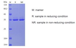 Bon Opus Biosciences Recombinant Mouse Apolipoprotein E/ApoE (C-His) - Source: Human 293 Cells