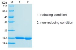 Bon Opus Biosciences Recombinant Human IL-33 - Source: E.coli, Quantity: