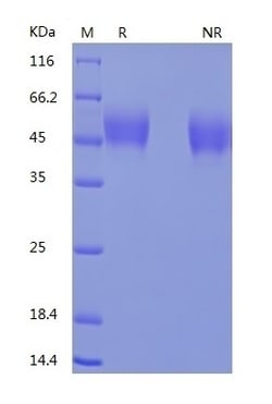 Bon Opus Biosciences Recombinant Human SIRP alpha/CD172a (C-His) - Source: