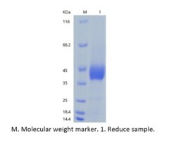 Bon Opus Biosciences&nbsp;Recombinant Human Mesothelin/MSLN (C-His) - Source: Human 293 Cells