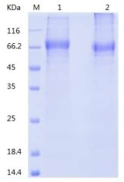 Bon Opus Biosciences Recombinant Human Siglec-5/CD170 (C-His) - Source: