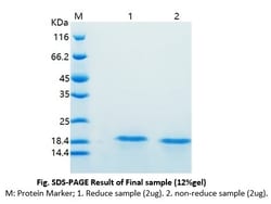 Bon Opus Biosciences Recombinant Human GFAP protein (N-His) - Source: E. coli