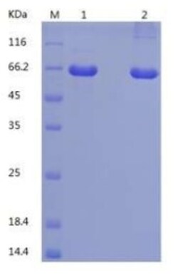 Bon Opus Biosciences Recombinant Human Calnexin Protein (C-His) - Source: