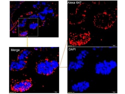 Immunology Consultants Monoclonal Mouse anti-Human Epididymis Protein 4