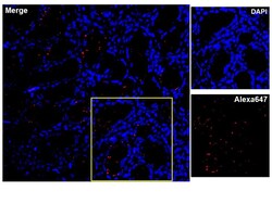 Immunology Consultants Monoclonal Mouse anti-Helicobacter pylori Antibody
