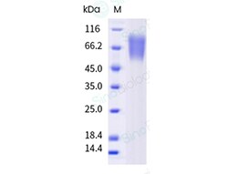 Sino Biological Recombinant Human TrkA Protein (His Tag), HPLC-verified,