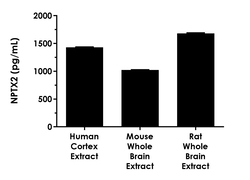 Abcam Anti-FREM2 antibody, Quantity: Each of 1