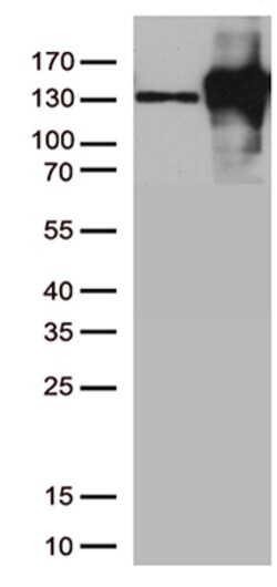 BIORBYT LLC NCadherinAntibody, Quantity: Each of 1