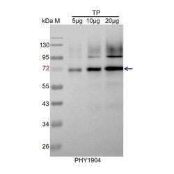 PHYTO AB INC RpoC1 Antibody Immunogen: ATCG00180 Background: RNA polymerase