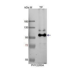 PHYTO AB INC H+ATPase Antibody Immunogen: AT2G18960 AT4G30190 AT5G57350