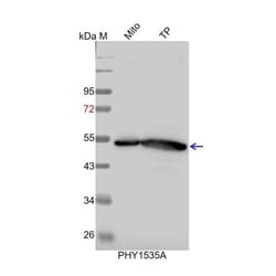 PHYTO AB INC CAT3 Antibody Immunogen: AT1G20620 Background: Catalase is