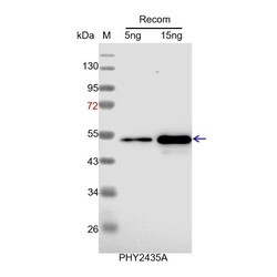 PHYTO AB INC&nbsp;ARF2 Antibody Immunogen: AT5G62000 Background:  ARF2 could act as transcriptional activator or repressor. And it may act as a repressor of cell division and organ growth. 150ug/EA