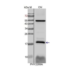 PHYTO AB INC&nbsp;PAM68 Antibody Immunogen: AT4G19100 Background: PAM68 is a conserved integral membrane protein which interacts with several PSII core proteins and known PSII assembly factors. 150ug/EA