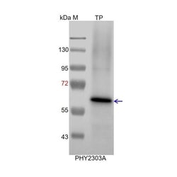 PHYTO AB INC&nbsp;NADP-ME2 Antibody Immunogen: AT5G11670 Background: NADP-ME2 has been involved in sugar metabolism in veins and in the oxidative burst triggered by hemibiotrophic fungal infection. 150ug/EA