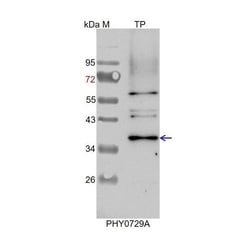 PHYTO AB INC ANN1 Antibody Immunogen: AT1G35720 Background: Annexin (ANN)