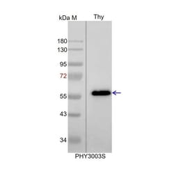 PHYTO AB INC&nbsp;ATPA Antibody Immunogen: ATCG00120 Background: ATPase alpha subunit is part of the CF1 portion which catalyzes the conversion of ADP to ATP using the proton motive force. 150ug/EA