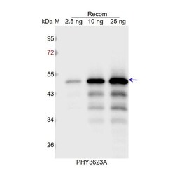 PHYTO AB INC&nbsp;RGA1 Antibody Immunogen: AT2G01570 Background: RGA isa member of the VHIID/DELLA regulatory family. DELLAs repress cell proliferation and expansion that drives plant growth.  150ug/EA