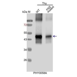 PHYTO AB INC&nbsp;PSBB Antibody Immunogen: ATCG00680  Background: CP47 is one of the components of the core complex of PSII. 150ug/EA