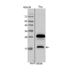 PHYTO AB INC&nbsp;YCF4 Antibody Immunogen: ATCG00520  Background: YCF4 is a protein required for photosystem I assembly and stability. 150ug/EA