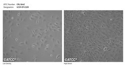 UCSF-OT-1109 (ATCC CRL-3442) Human Oral Tongue Squamous Cell Carcinoma Cell Line - Frozen, Adherent, Epithelial-like