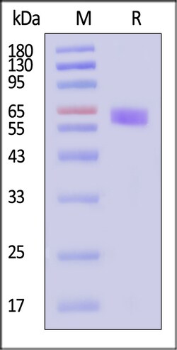 ACROBiosystems Human LRRC15 / LIB Protein His Tag MALS verified, Quantity: