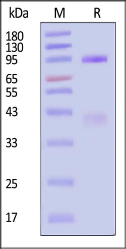 ACROBiosystems Mouse HGF R / c-MET Protein His Tag MALS verified 100 ug,