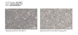 ATCC Seneca Valley virus (ATCC VR-1989), Quantity: Each of 1