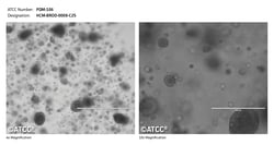 ATCC ATCC PDM-106 (HCM-BROD-0008-C25) patient-derived pancreatic organoid,