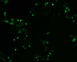 Sino Biological&nbsp;Human, Argonaute-2/AGO2 cDNA ORF Clone, C-GFPSpark tag