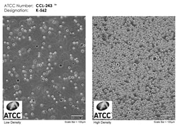 ATCC&nbsp;K-562 are lymphoblast cells isolated from the bone marrow of a 53-year-old chronic myelogenous leukemia patient. The K-562 cell line is widely used in immune system disorder and immunology research.