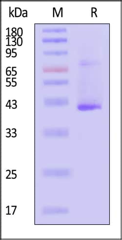 ACROBiosystems Biotinylated Human STEAP1 Full Length Protein, 100 μg, expressed