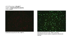 Chlamydia abortus (Everett et al.) Sachse et al. - Strain B-577, ATCC VR-656, Frozen Culture