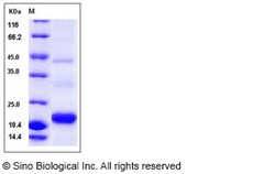 Sino Biological&nbsp;Recombinant Human PDGF-C Protein (His Tag)