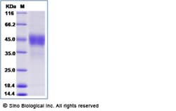 Sino Biological Recombinant Cynomolgus, Rhesus TROP-2 Protein (His Tag), HPLC-verified, 1mg