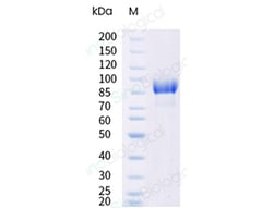 Sino Biological INFLUENZA A H3N2 A DARWIN 6 2