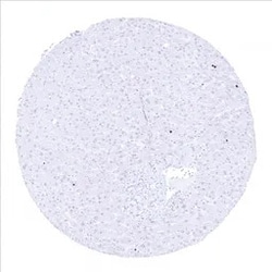 Genetex Inc&nbsp;Ki67 Monoclonal Antibody [MSVA-267M] HistoMAX™ (GTX04361) GeneTex - IHC-Optimized Antibody