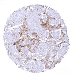 Genetex Inc PD-L1 Monoclonal Antibody [MSVA-711R] HistoMAX™ (GTX04362) GeneTex - IHC-Optimized Antibody