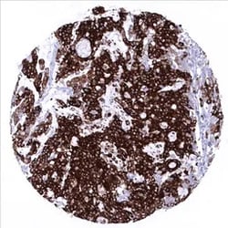 Genetex Inc&nbsp;Mucin 5AC Monoclonal Antibody [MSVA-109M] HistoMAX™ (GTX04364) GeneTex - IHC-Optimized Antibody.