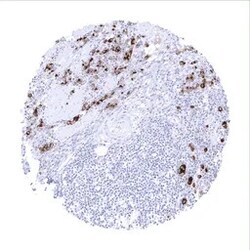 Genetex Inc&nbsp;Mesothelin Monoclonal Antibody [MSVA-235M] HistoMAX™ (GTX04373) GeneTex - IHC-Optimized Antibody.