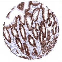 Genetex Inc&nbsp;Cytokeratin 18 Monoclonal Antibody [MSVA-118R] HistoMAX™ (GTX04374) GeneTex - IHC-Optimized Antibody.