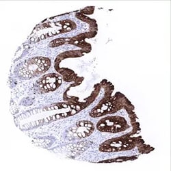 Genetex Inc&nbsp;Cytokeratin 20 Monoclonal Antibody [MSVA-620R] HistoMAX™ (GTX04376) GeneTex - IHC-Optimized Antibody.
