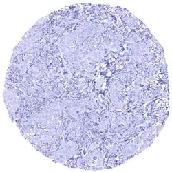 Genetex Inc&nbsp;EpCAM Monoclonal Antibody [MSVA-326R] HistoMAX™ (GTX04380) GeneTex - IHC-Optimized Antibody.