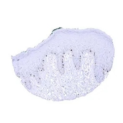 Genetex Inc&nbsp;Melanoma gp100 Monoclonal Antibody [MSVA-617R] HistoMAX™ (GTX04382) GeneTex - IHC-Optimized Antibody.