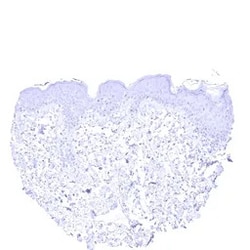Genetex Inc&nbsp;Cytokeratin 13 Monoclonal Antibody [MSVA-613M] HistoMAX™ (GTX04385) GeneTex - IHC-Optimized Antibody.