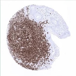 Genetex Inc&nbsp;CD20 Monoclonal Antibody [MSVA-020R] HistoMAX™ (GTX04392) GeneTex - IHC-Optimized Antibody.