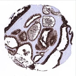 Genetex Inc Prostatic Acid Phosphatase Monoclonal Antibody [MSVA-452M] HistoMAX™ (GTX04396) GeneTex - IHC-Optimized Antibody.