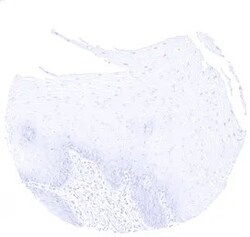 Genetex Inc Cytokeratin 10 Monoclonal Antibody [MSVA-610M] HistoMAX™ (GTX04401) GeneTex - IHC-Optimized Antibody.
