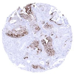 Genetex Inc Cytokeratin 6 Monoclonal Antibody [MSVA-606R] HistoMAX™ (GTX04403) GeneTex - IHC-Optimized Antibody.